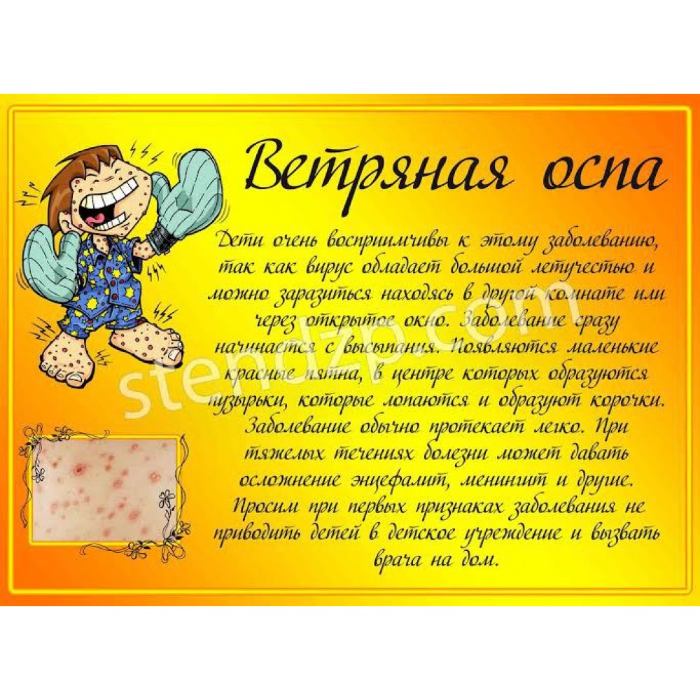 Медицинский стенд Оспа
